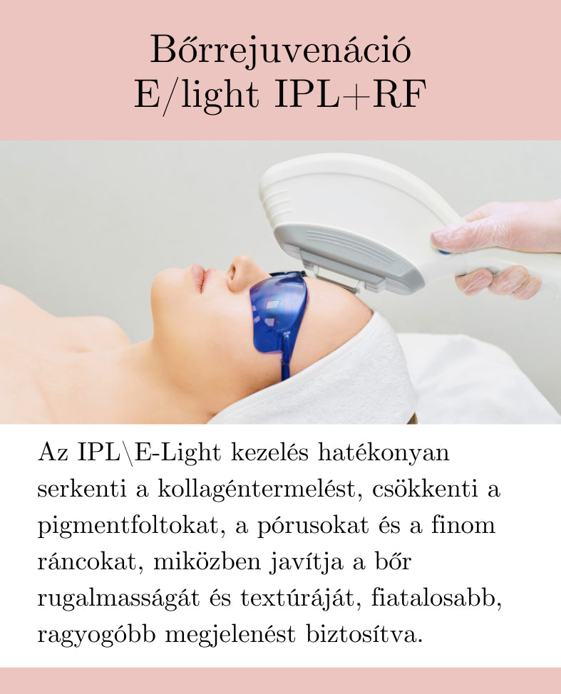 Bőrrejuvenáció / E-light IPL+RF kezelés