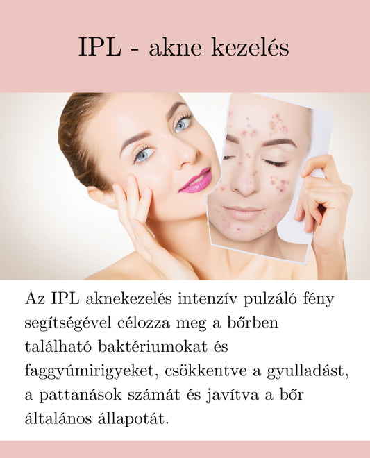 IPL - akne, heg kezelés